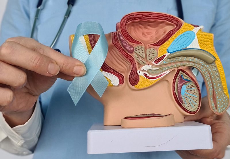 Doctor-holding-a-blue-ribbon-and-a-model-of-male-reproductive-system