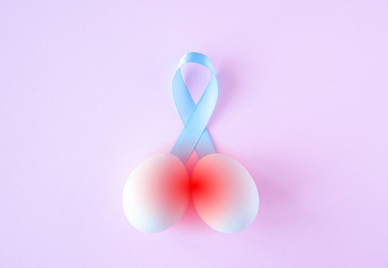 Image-representing-prostate-cancer-awareness